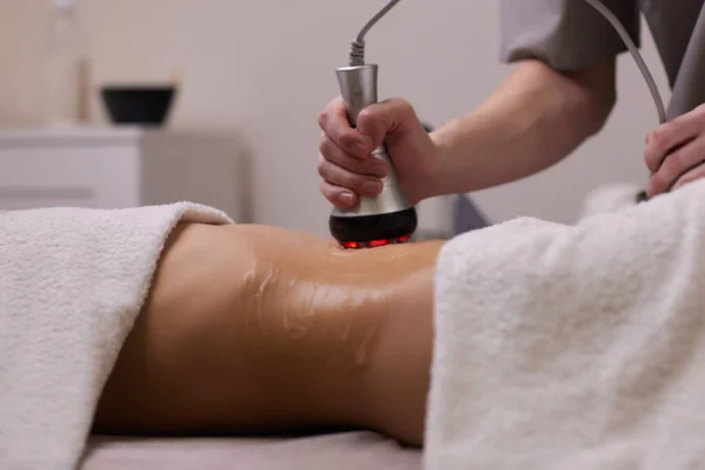 Cavitation